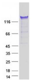 SDS-PAGE (PUM1-2883H).jpg